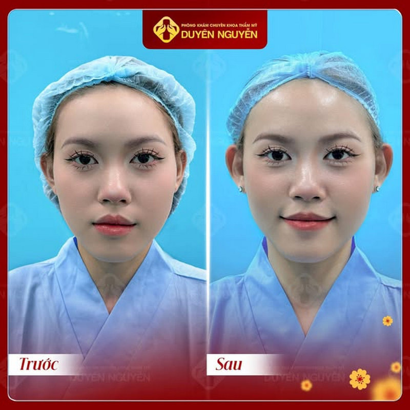 Dáng tai vểnh phong thủy được nhiều người ưa chuộng