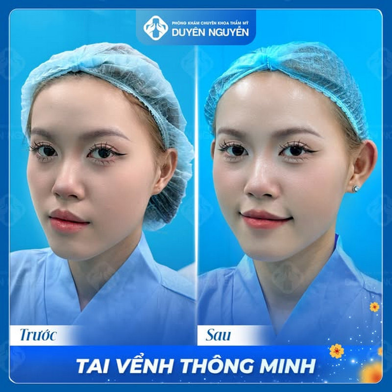 Mẫu tai vểnh phong thủy được nhiều người yêu thích