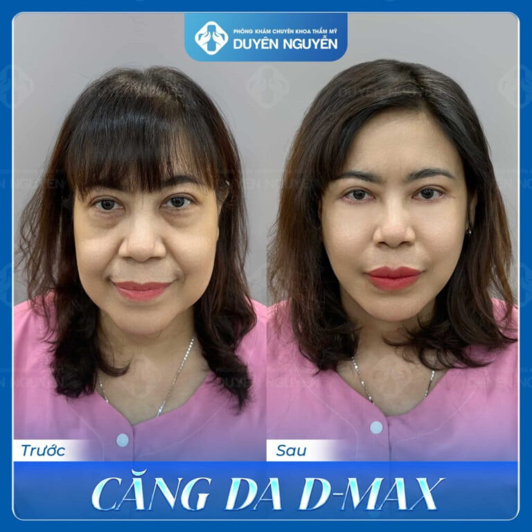 Hình ảnh khách đã sử dụng dịch vụ tại phòng khám Duyên Nguyễn 