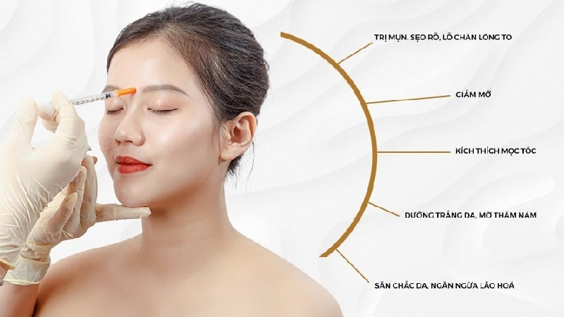 Tiêm meso trẻ hóa