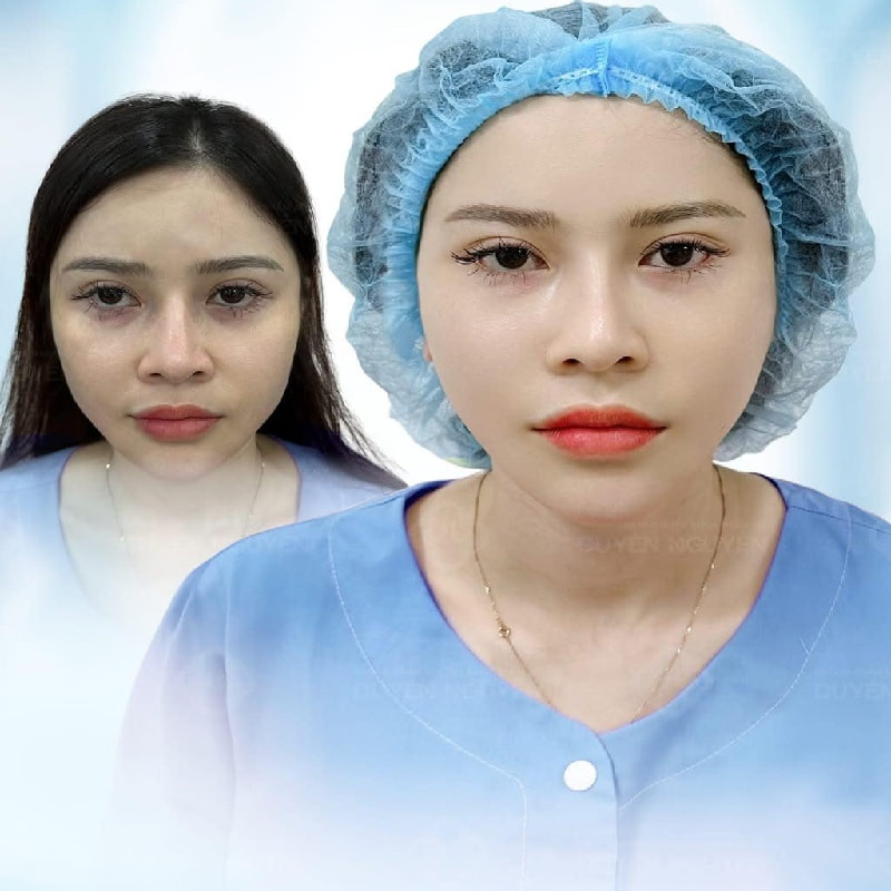 Mới hơn 25 nhưng có nếp nhăn trông già trước tuổi thì căng da mặt giúp trẻ hóa