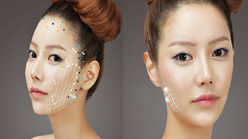 Bác sĩ đánh giá tình trạng lão hóa da từng đối tượng khách hàng rõ ràng