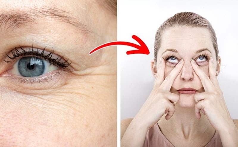 Nếp nhăn mắt là các đường rãnh xuất hiện quanh mắt