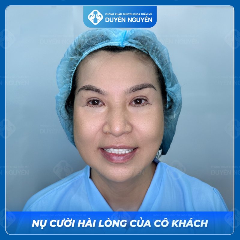 Tạo dáng chân mày hình cánh cung phù hợp gương mặt tròn