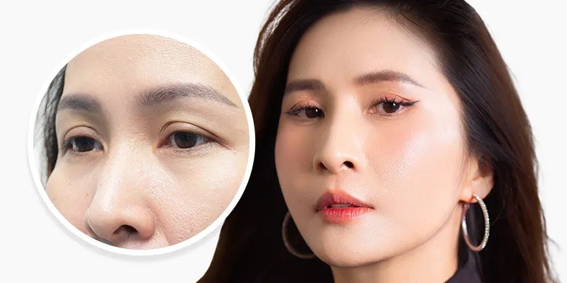 Nâng cung mày có ảnh hưởng đến tướng số không, thay đổi diện mạo cải thiện vận số