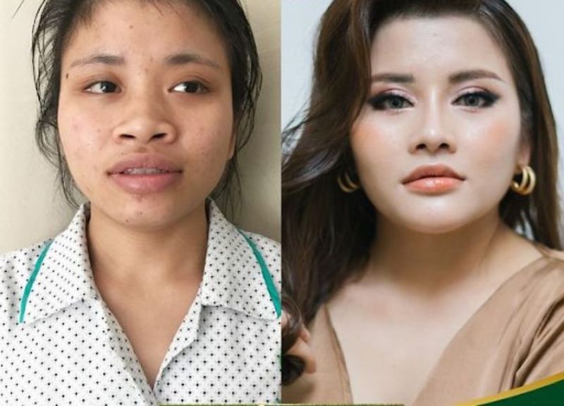 Nâng cung mày được giúp gương mặt trẻ trung, thanh tú tự nhiên so với phun xăm