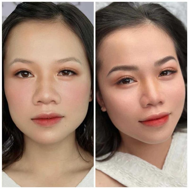 Cung mày sa trễ khiến gương mặt kém sắc, mắt buồn