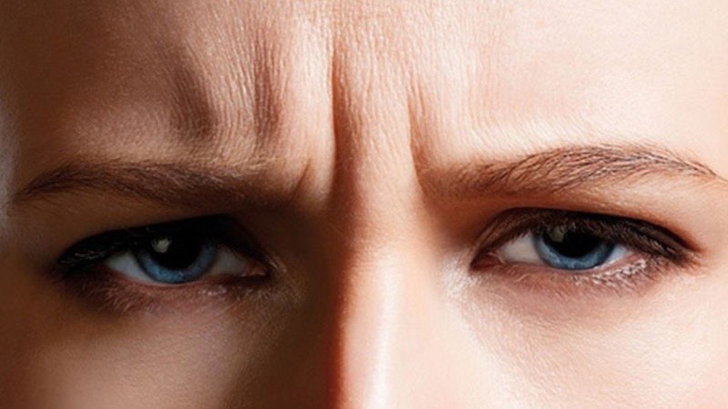 Nếp nhăn cau mày ảnh hưởng đến thẩm mỹ gương mặt lẫn thần thái